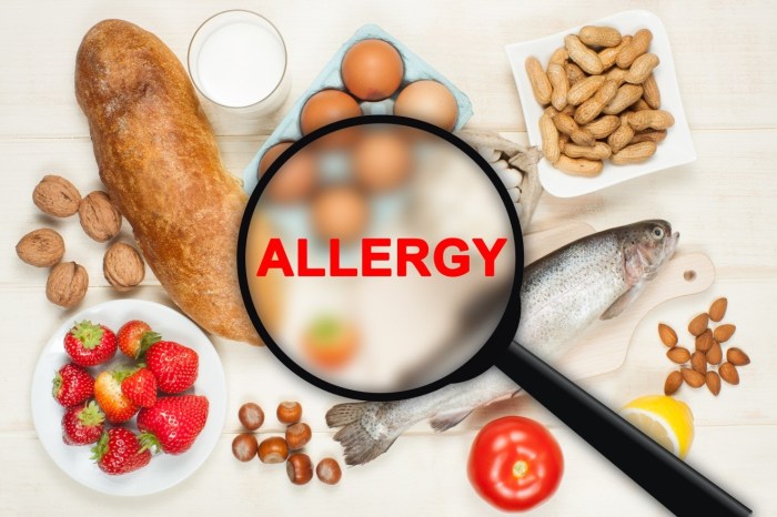 Tips Cegah Alergi Makanan pada Anak