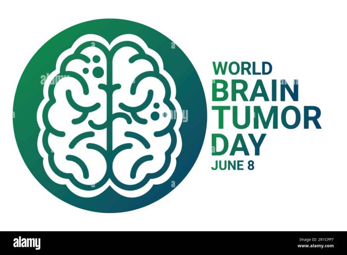Sejarah Hari Tumor Otak Sedunia yang Diperingati Setiap 8 Juni